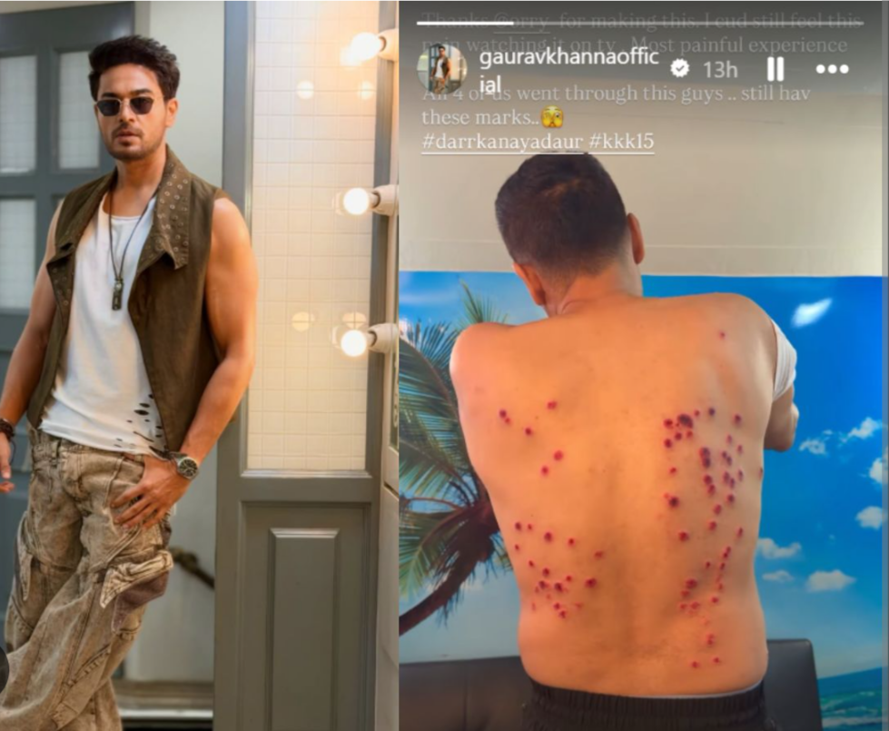 Gaurav Khanna Injured During Painful Khatron Ke Khiladi 15 Task